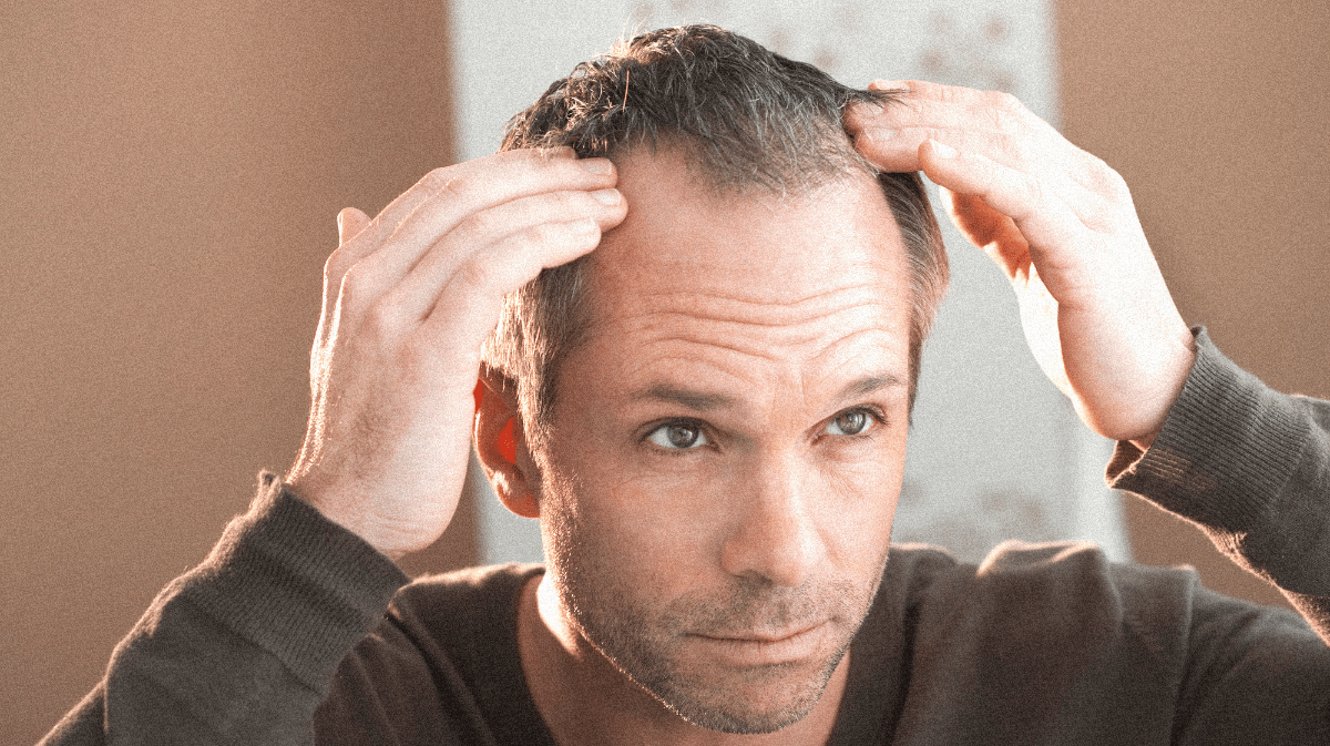 Portrait photo : quelle coupe choisir quand on perd ses cheveux ? - Le